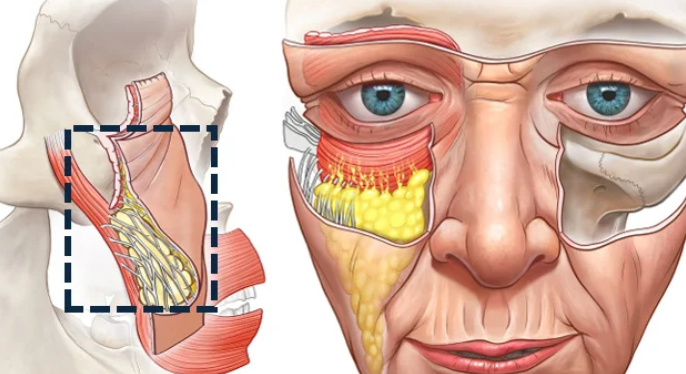 杭州苹果肌复位好的医生:蹇洪侧重深层固定,黄良飞风格自然不突兀
