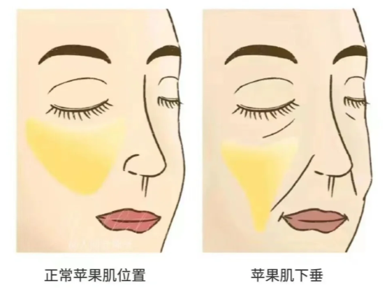 杭州苹果肌复位好的医生核心亮点:一眼看清优势 + 适配人群