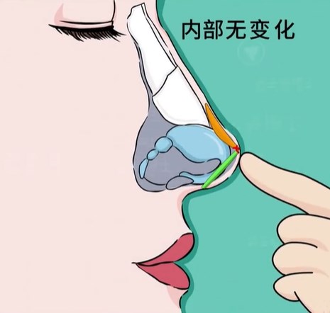 牛永敢隆鼻没有黑历史