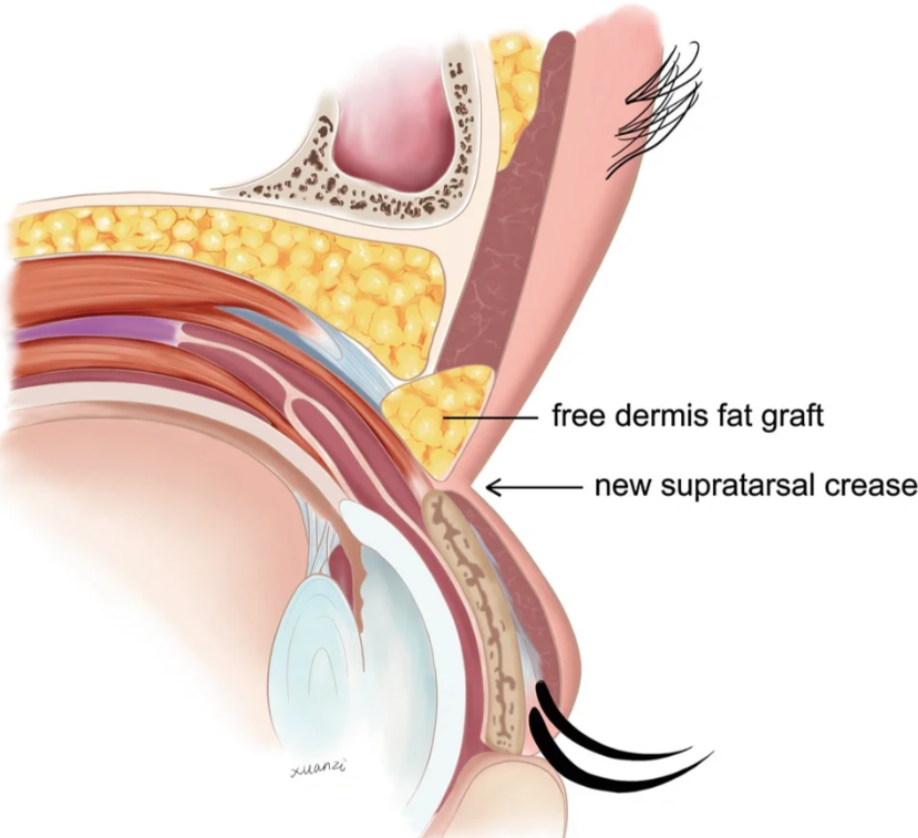 上海颜净赵鹏医生预约挂号攻略！联系电话(021) 33565088，官网 / 到店 / 公众号三渠道任选～