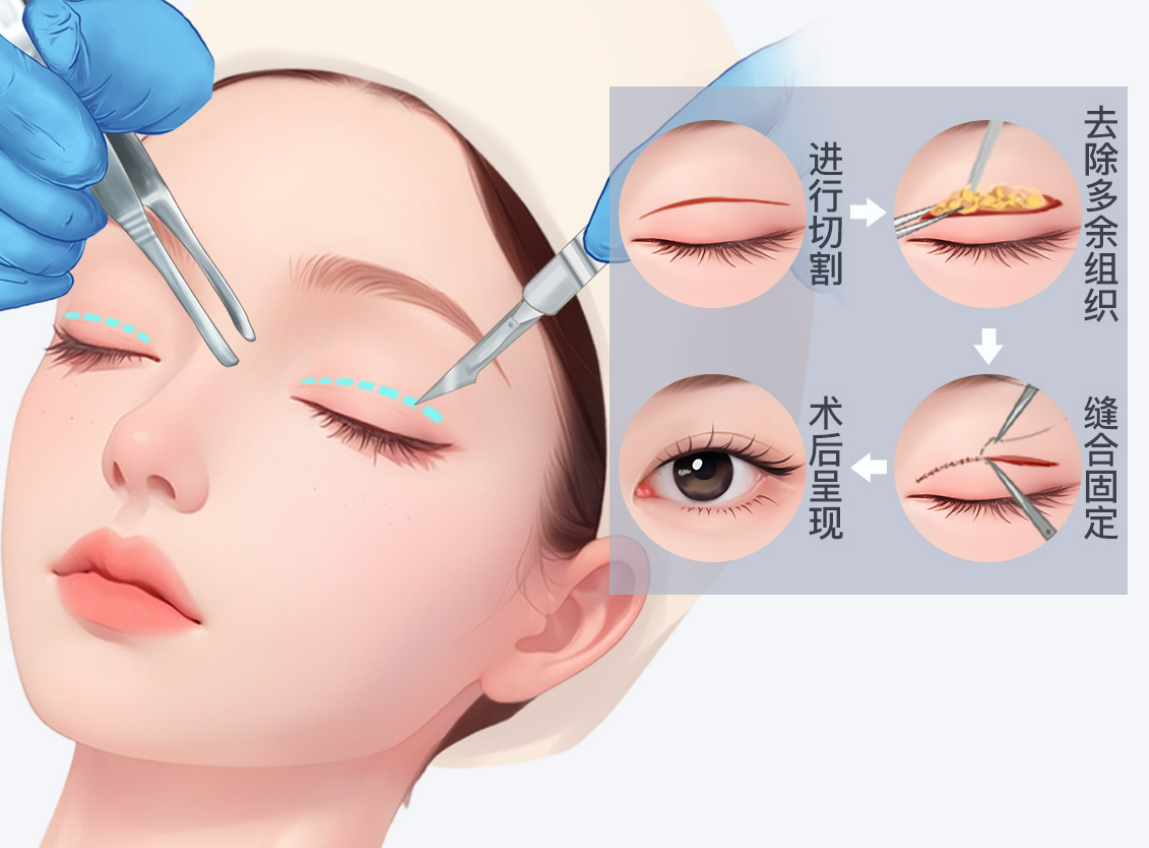 上海颜净赵鹏医生预约挂号联系电话