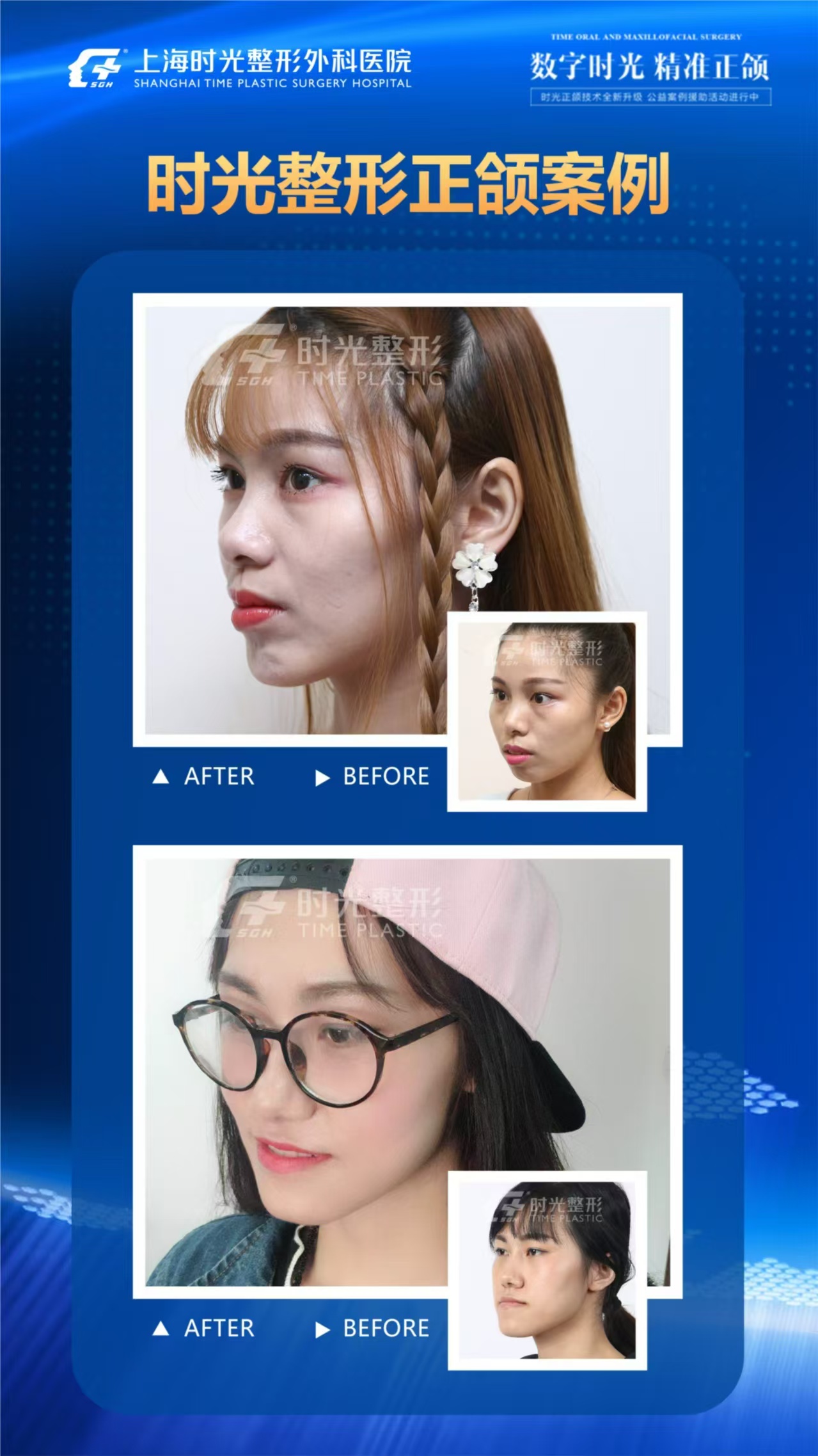 何锦泉跟艾伟健正颌哪个好？用户反馈何锦泉18年经验更懂需求，比艾伟健更贴心