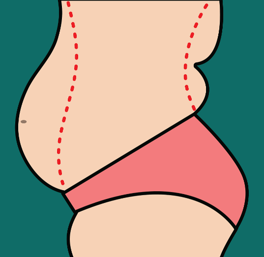 郑州李广平吸脂价格避坑:远离100元/128元低价套路