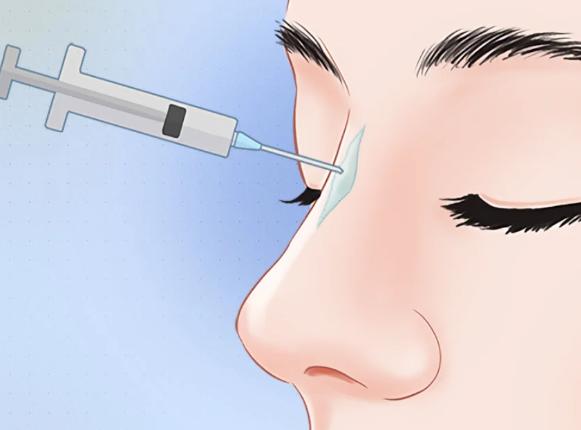 乔雅登越致能打鼻子,核心优势在哪?