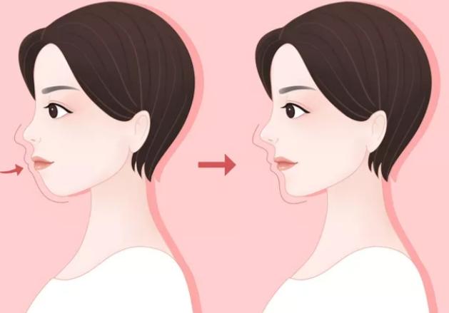 何锦泉跟艾伟健正颌哪个好