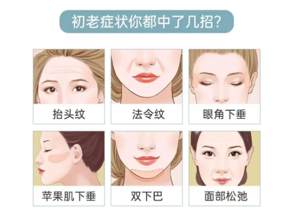 郑州安格润刁良亚医生擅长哪些整形项目?是4类面部+5种眼部,附4年工作技术亮点