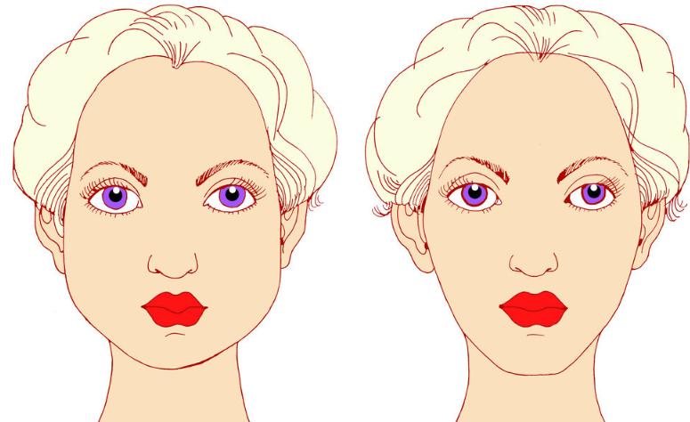 广州口角囊袋改善的常见疑问解答