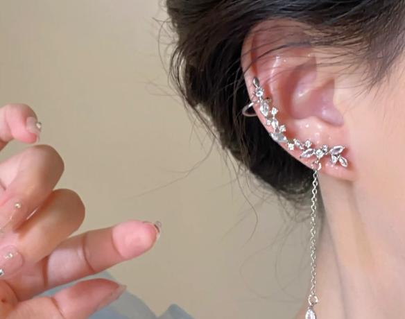 郑州精灵耳吴占飞亲测:刘博士膨体繁星做得细,3个月效果自然没踩坑