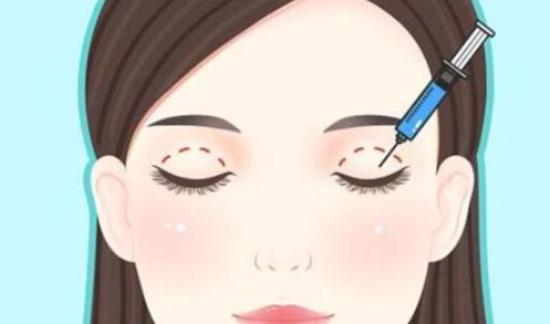 上海罗文婷医生是千美医生吗？是！附她擅长的3种眼型和5例双眼皮案例