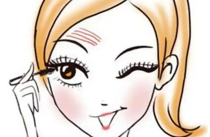 上海千美罗文婷双眼皮实例及患者真实评价