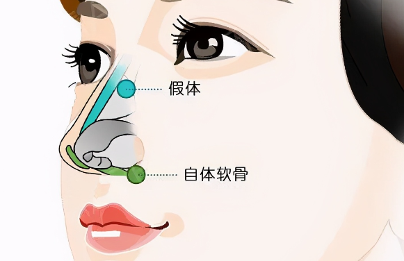 张承武现在在哪个医院做鼻子