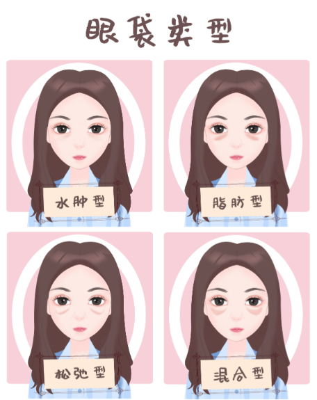 郑州眼袋修复王杨医生简介：眼周宝藏医生，3大硬核技术，眼袋修复+泪沟填充+卧蚕重塑一步到位