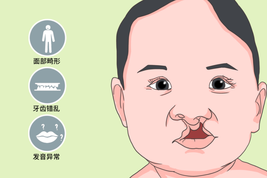 紧急求助必看！唇腭裂24小时免费线上问诊！10分钟响应，术前术后+免费手术政策全解答～