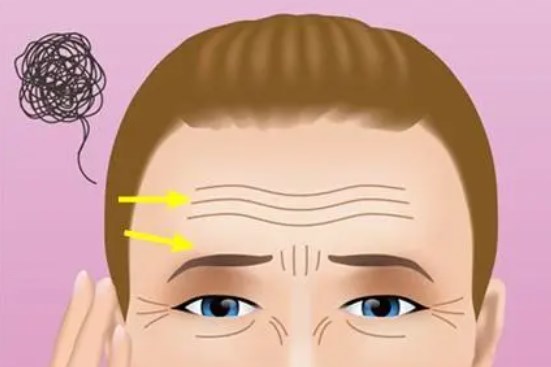 张路面部三件套是坑人的吗?当然不是!0.3mm 导针筋膜锚定,苹果肌自然归位实测靠谱~