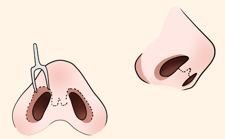 (二)预约注意事项