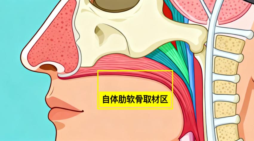 找哈尔滨龚宇做鼻子真实反馈来了，技术好但预约真的难吗？