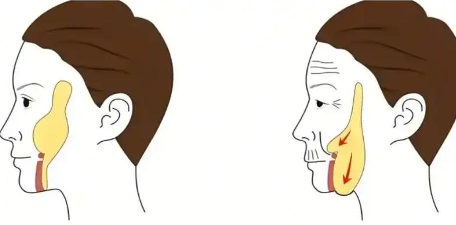 陈凤超和谢宏彬面部提升价格参考www.aimei.com