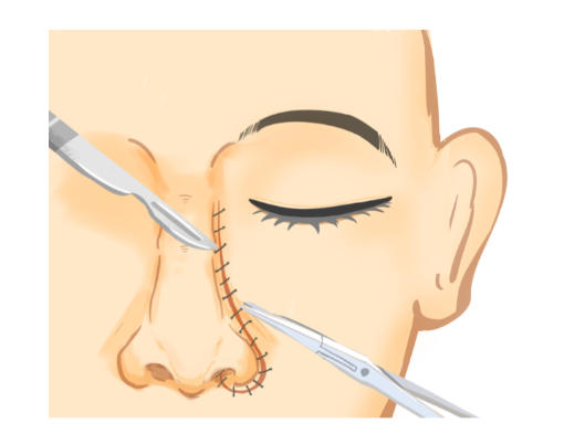 巫文云隆鼻的价格区间及透明度分析www.aimei.com