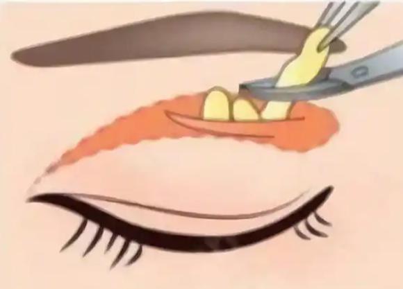 二、刘韶瑞和郑小红哪个修复技术好?实例对比