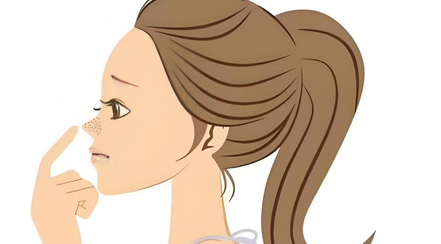 北京李长富鼻修复多少钱?常规鼻修复4.3万,多次失败鼻修复7万,假体取出1.2万