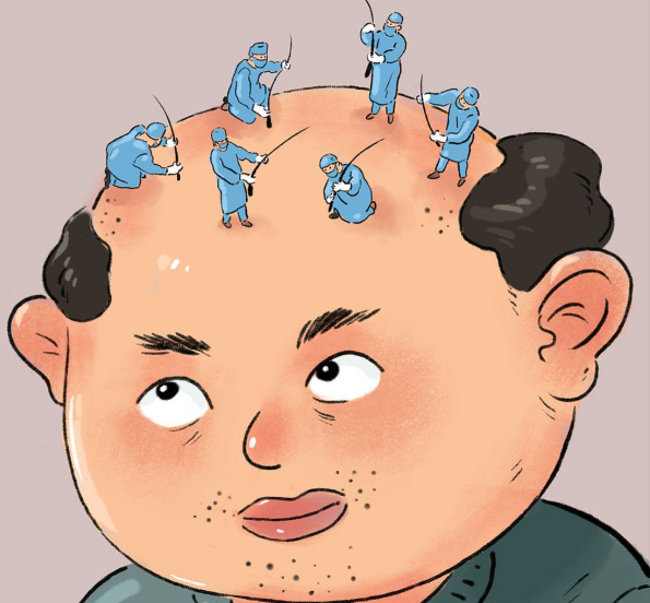 2025年植发行业新趋势