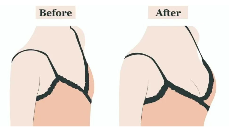 在无锡面诊了5家有名的丰胸医院，排名靠前的医生报价都在这了