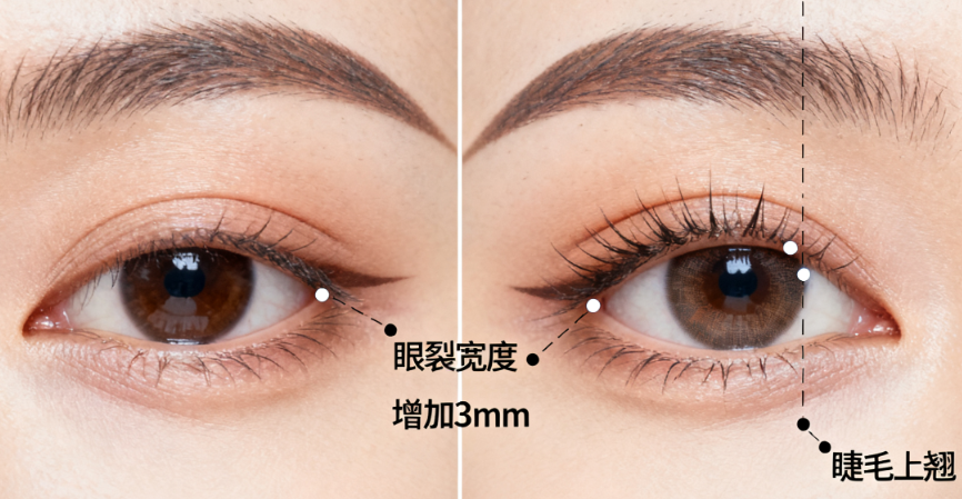 上海杨晨光双眼皮怎么预约?坐诊上海千意美整形,亲测预约流程超详细分享