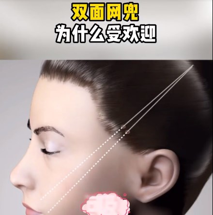 北京颈部拉皮手术价格参考及影响因素