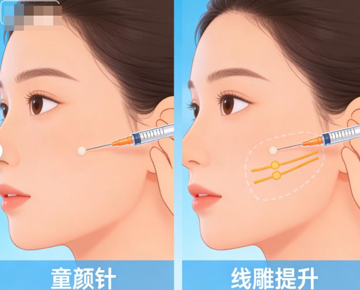 何晋龙和何锦泉正颌谁厉害一点？各有所长，何晋龙复杂双颌更擅长，何锦泉微创正颌更出色