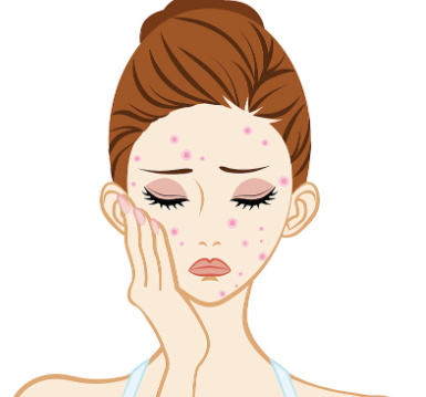 太原祛斑黑色素哪里好