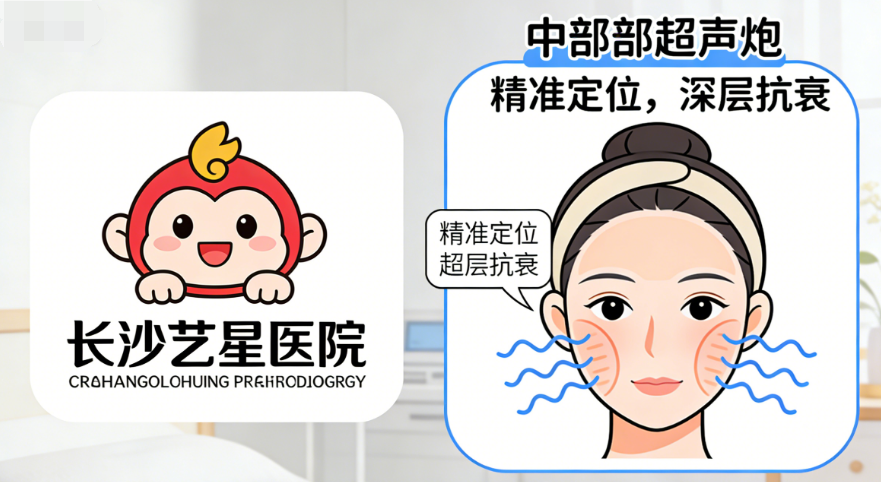 湖南哪里做中面部超聲炮