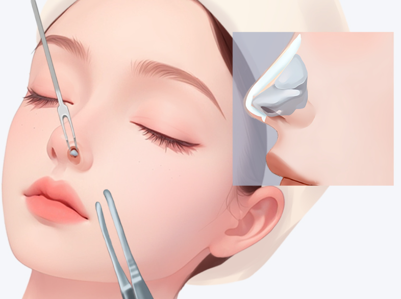 岳伟骨雕鼻一支价格