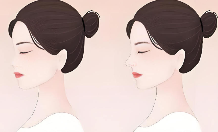 上海岳伟医生骨雕鼻价格表