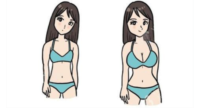 曼托水滴假體255cc術(shù)后3個月變好療效