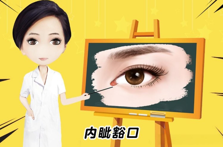 五、方涛医生与其他眼修复医生的对比:单侧/内眼角修复的优势