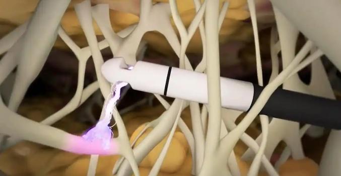 王跃星大腿吸脂整形失败案例有吗？郑州美莱医生真实案例曝光，术后满意度比较高