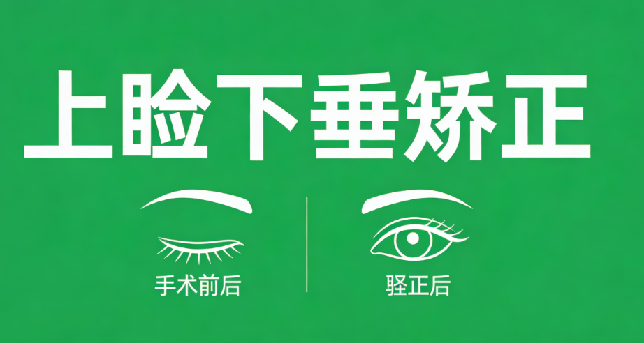 谭敏峰上睑下垂矫正好