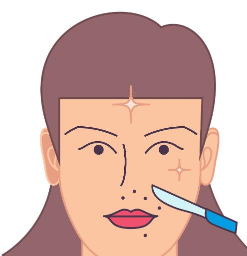 谢峰做切眉术怎么样