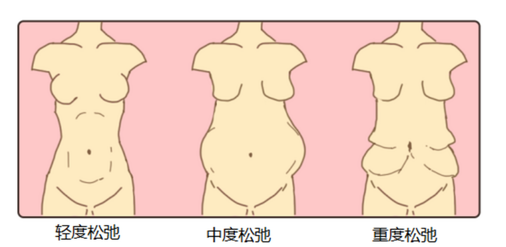 熊凌云腹壁整形怎么預(yù)約？網(wǎng)上線下及電話(huà)預(yù)約詳細(xì)攻略，附腹壁成型術(shù)技術(shù)優(yōu)勢(shì)解析