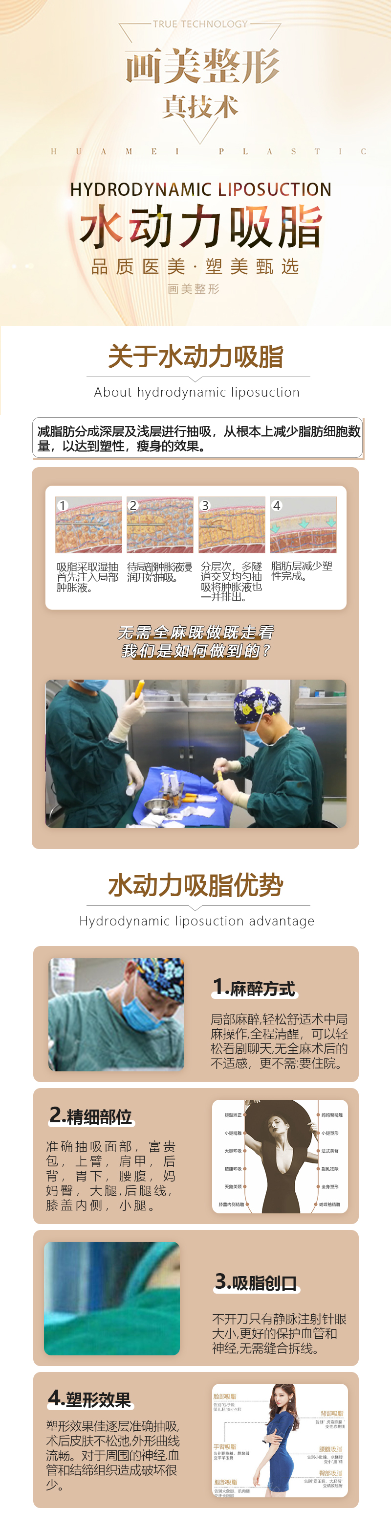 上海伯思立顾建成面部吸脂怎么样？重点看手法！他用微针分层吸，术后变好快且不凹凸