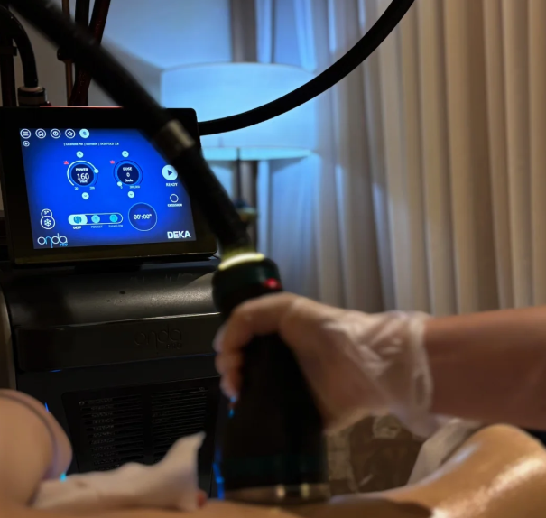 onda pro三代一次性打多少能量？按部位调才对，面部在60-130KJ左右