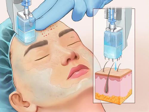 二、影响emface价格的4大关键因素及收费差异www.aimei.com