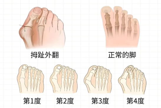 4. 并发症控制严格