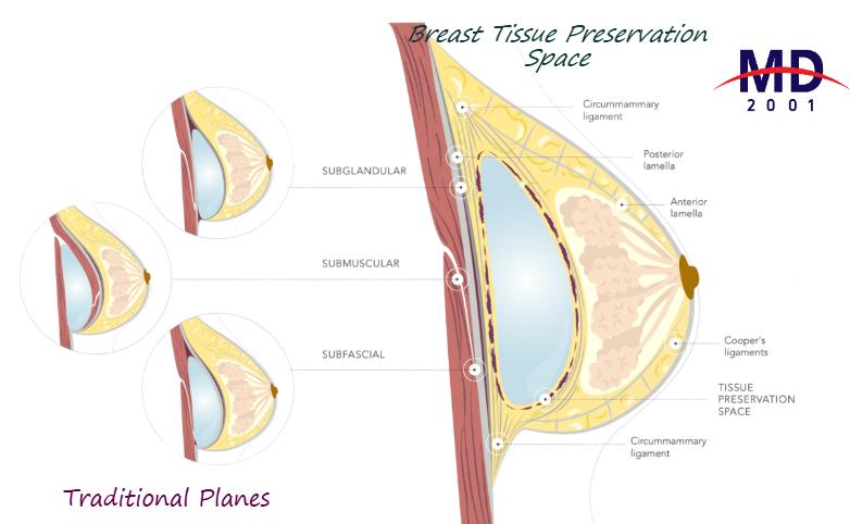 四、术后护理关键要点www.aimei.com