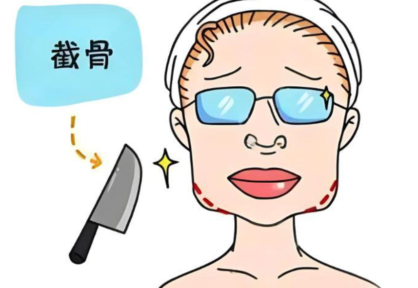 上海美立方磨骨收费价格是多少?2025年新版价目表大公开,下颌角3.8万起