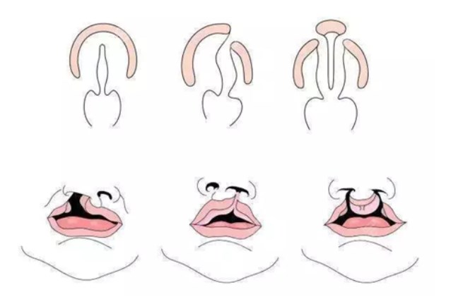 上海美立方整形医院价格表2025更新，唇腭裂修复2.8万，亲测不踩雷