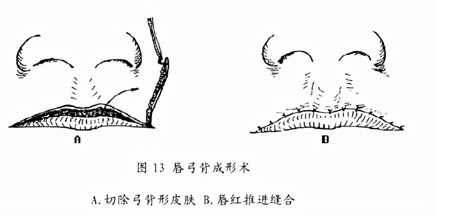 三、8家同城机构价格与实例对比
