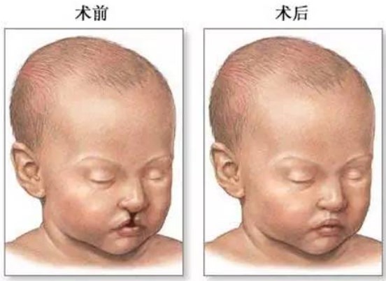 四、就诊攻略与注意事项www.aimei.com