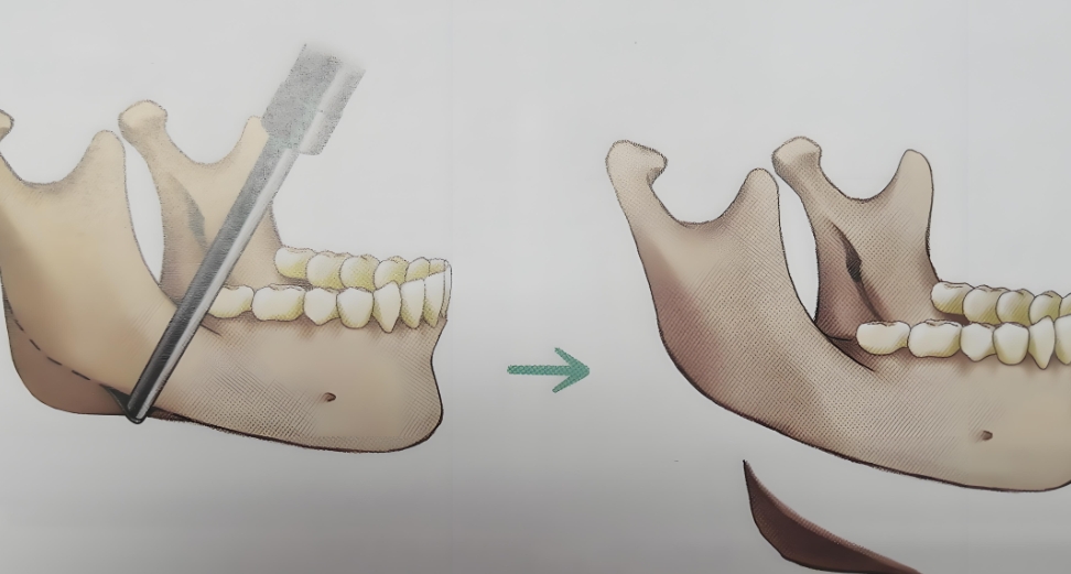 四、就诊全流程指南:如何预约袁捷医生