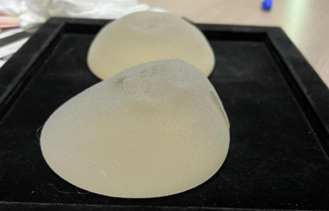 三、曼托水滴形隆胸假體價格：不同系列、型號的費用差異